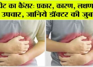 Stomach Cancer