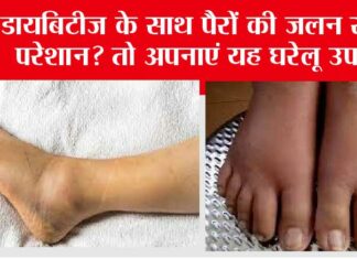 Diabetic Foot Irritation