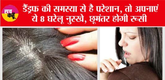 Get Rid Of Dandruff