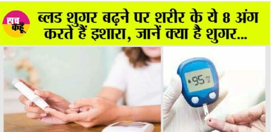 Symptoms of High Blood Sugar