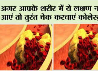 Signs your arteries full of cholesterol