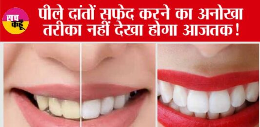 Teeth Cleaning in only 5 Minutes