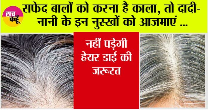 Natural Remedies For White Hair