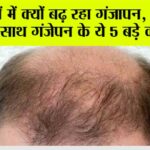 Hair Loss: