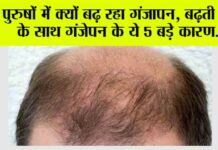 Hair Loss: