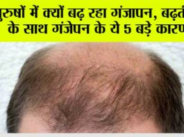 Hair Loss: